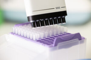 krebsfrueherkennung_A8A6113