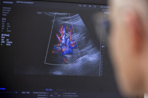 krebsnachsorge_A8A5823