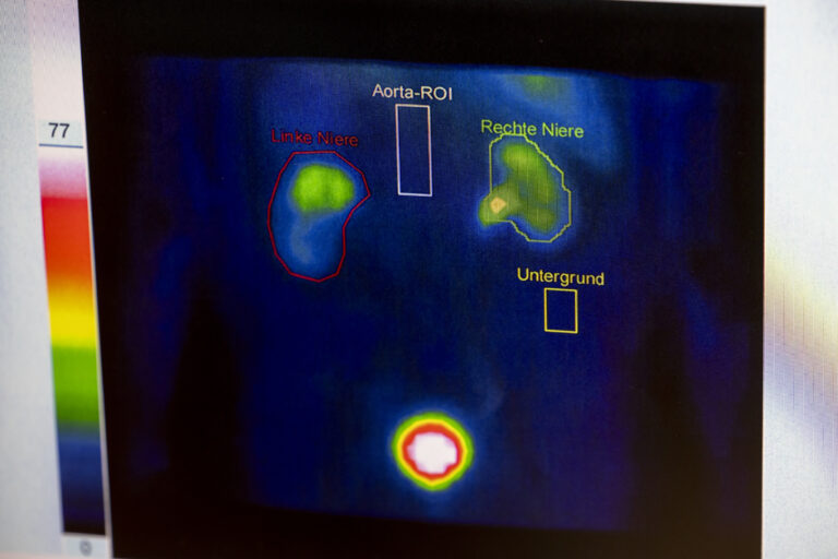 krebsnachsorge_A8A6229